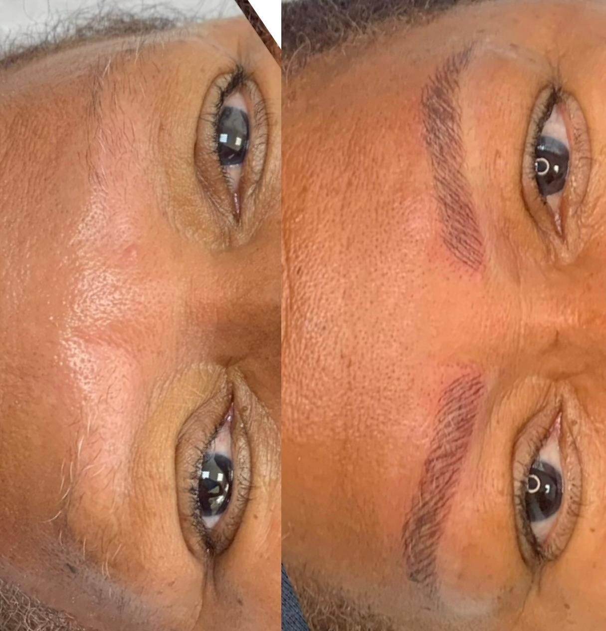 Micropigmentação fio a fio é aliada na recuperação da autoestima de quem sofre com alopecia nas sobrancelhas