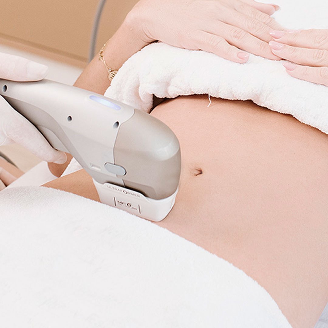 Ultraformer MPT estimula colágeno e redefine contornos faciais e corporais